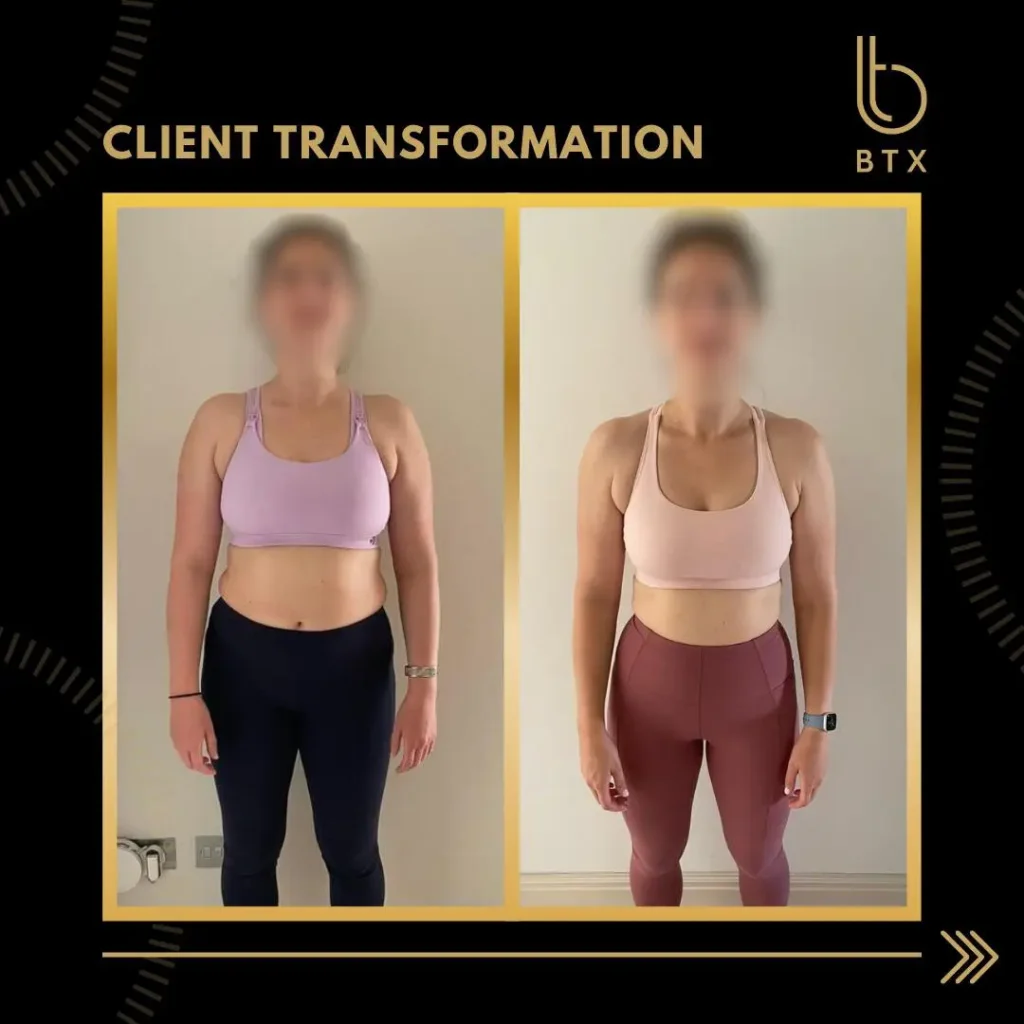 Sarah before and after her BTX transformation, faces blurred, standing front on