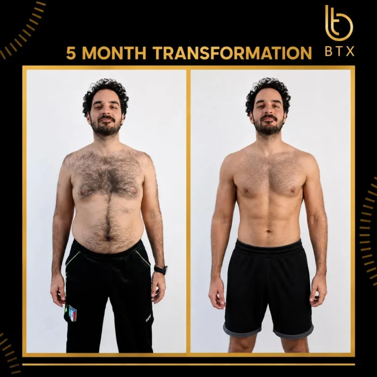 Fabio before and after his 5 month BTX transformation