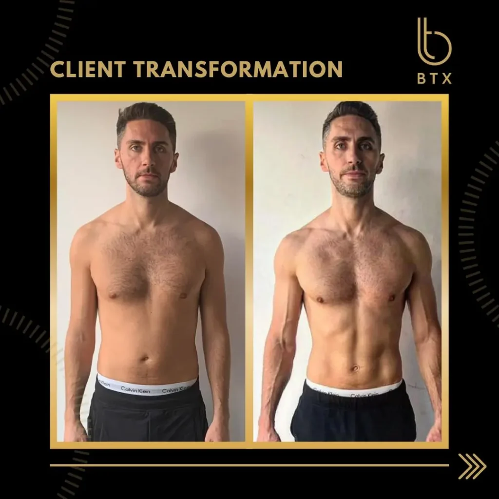 Sam before and after his BTX transformation, standing front on in shorts