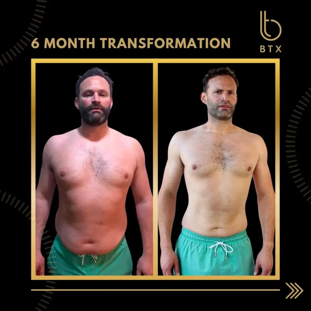 Robin before and after his 6 month BTX transformation, standing front on