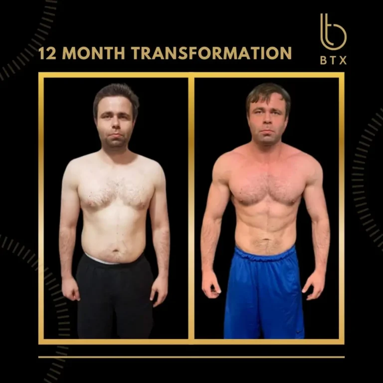 Matt before and after his 12 month BTX transformation