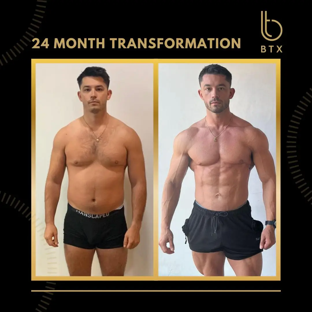 Piers before and after his 24 month BTX programme